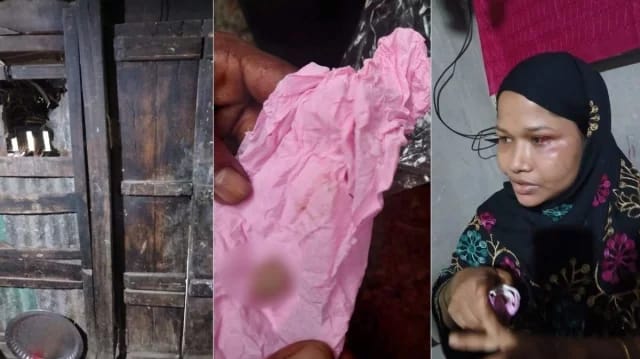 গভীর রাতে চুরির চেষ্টা, গৃহবধূর কামড়ে চোরের আঙুলের অংশ বিচ্ছিন্নের দাবি